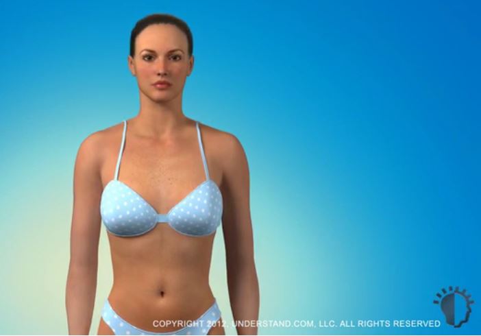 breast augmentation