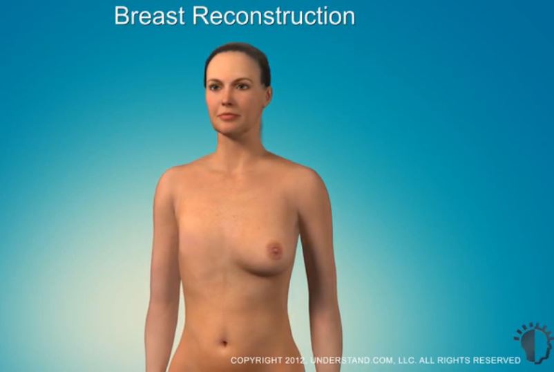 The image is of a woman with one breast removed.  You have to click on the image to watch the video.