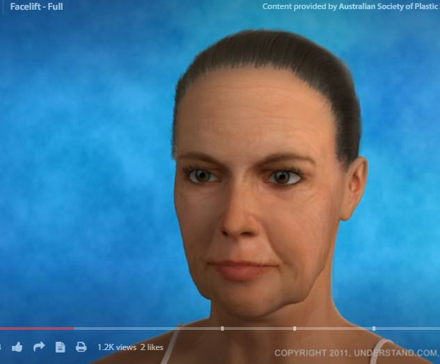 Click image to view video Viewer to click image to view video