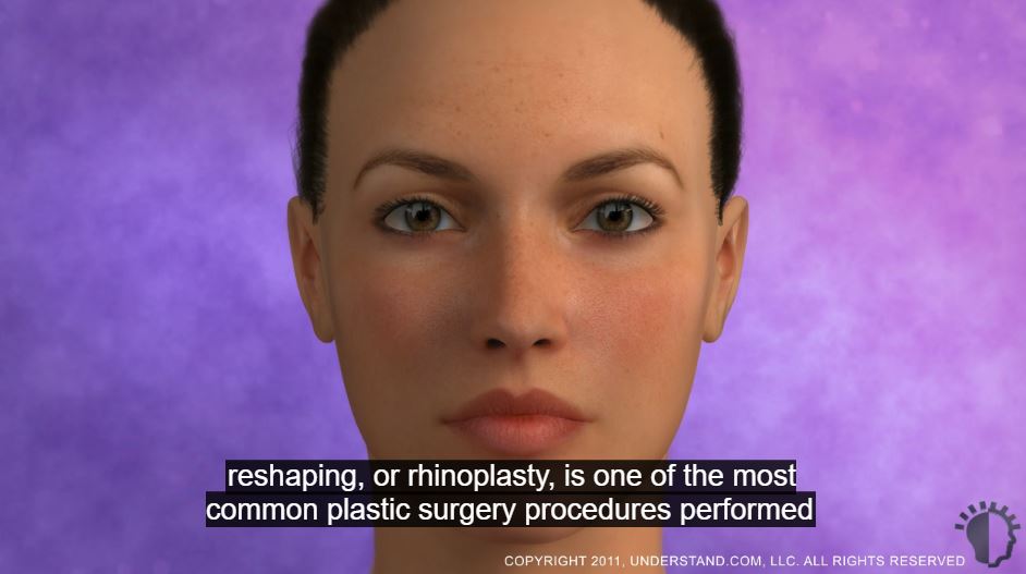 Rhinoplasty video Picture of a female face