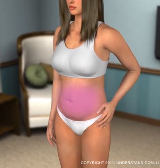 Click on image to view video Abdominoplasty video